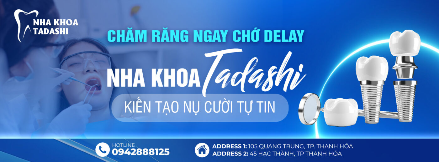 Nha Khoa Tadashi - Phòng Khám Răng Uy Tín Tại Thanh Hóa