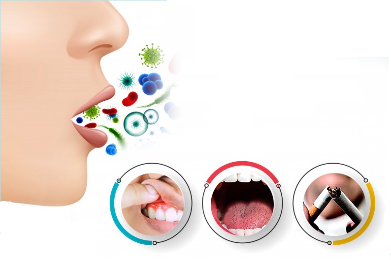 cách chữa hôi miệng hiệu quả