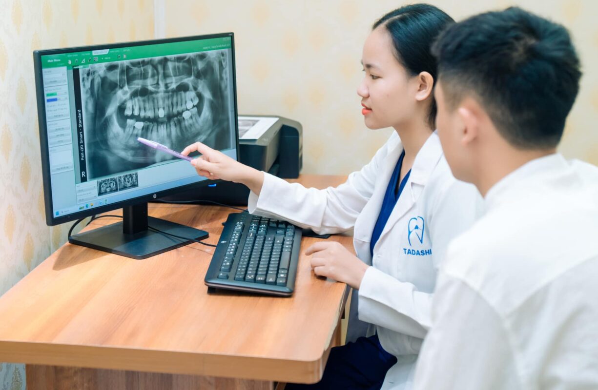 Chụp X-Quang Răng