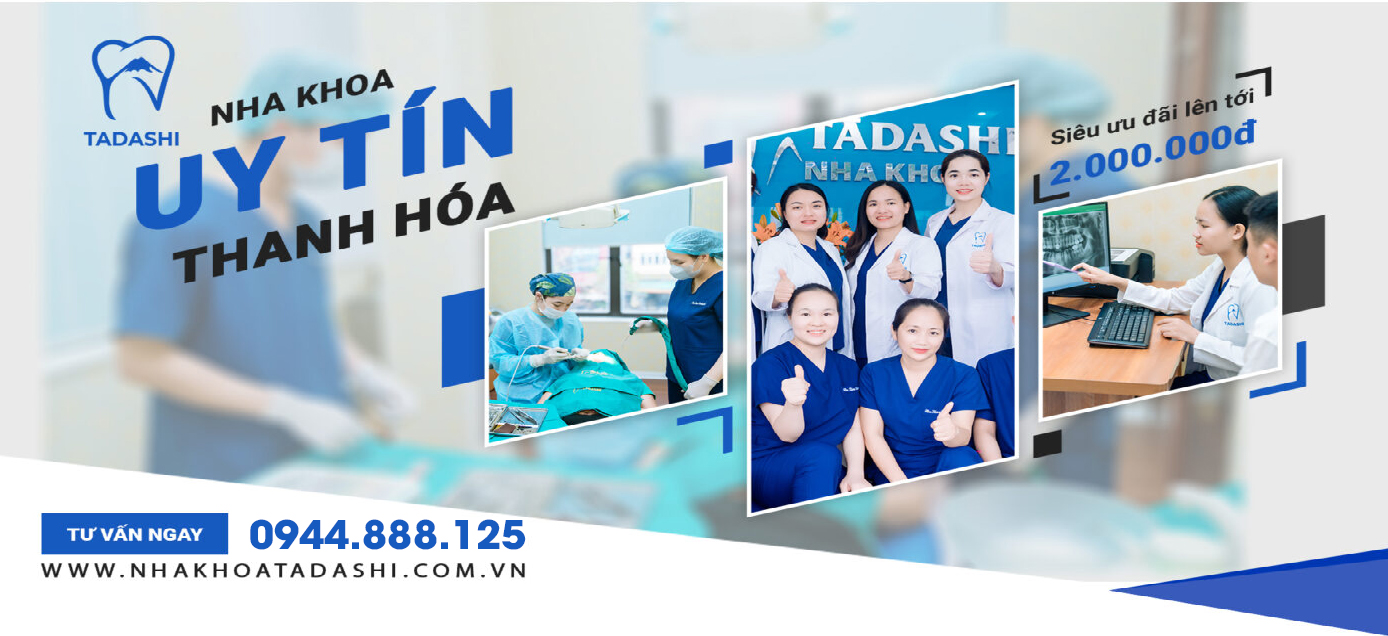 Nha Khoa Tadashi - Niềng Răng Uy Tín, Giá Tốt Tại Thanh Hoá