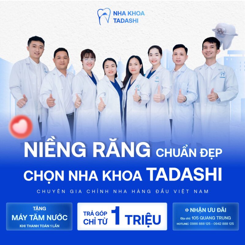 Niềng răng đẹp tại Thanh Hoá