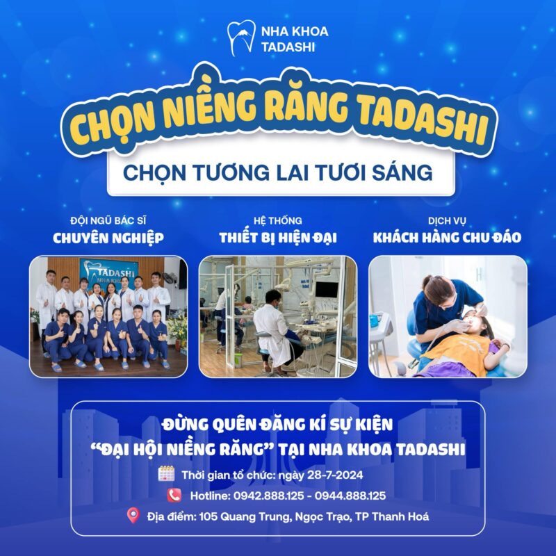 Niềng răngg thẩm mỹ tại nha khoa tadashi thanh hóa