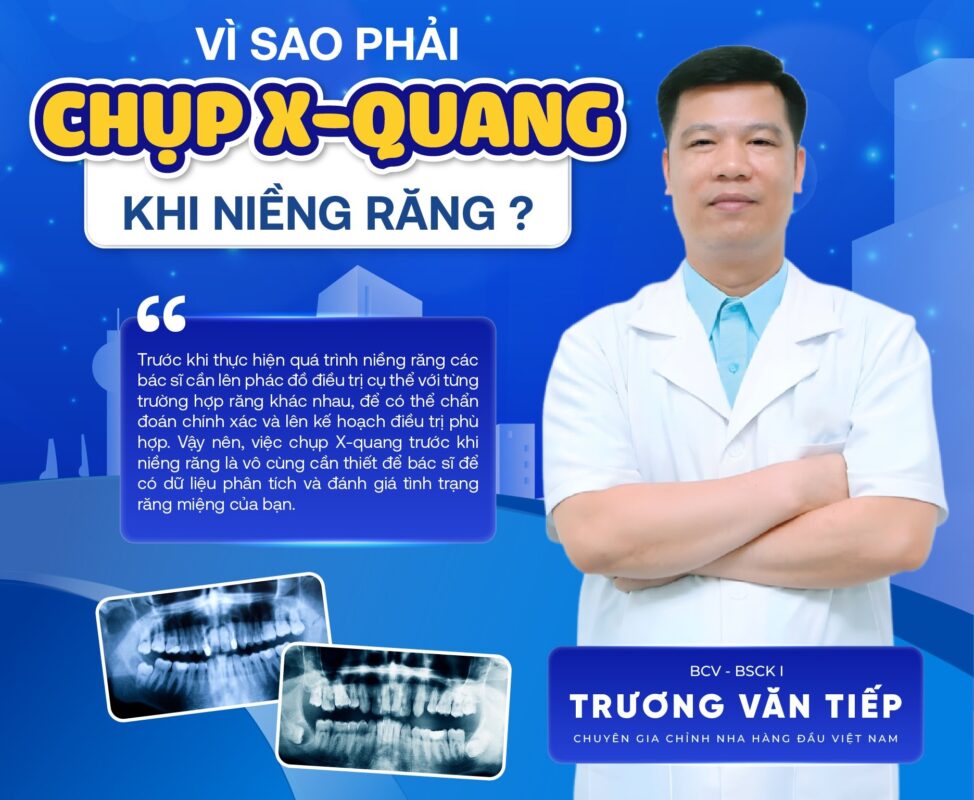 Vì sao phải chụp X-Quang Trước khi Niềng răng