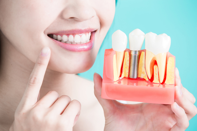 có nên cấy implant không và nên cấy khi nào